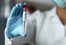 Ebola Fears Rise as Nigerian Scientists Demand Emergency Border Surveillance