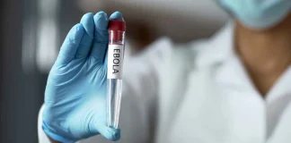 Ebola Fears Rise as Nigerian Scientists Demand Emergency Border Surveillance